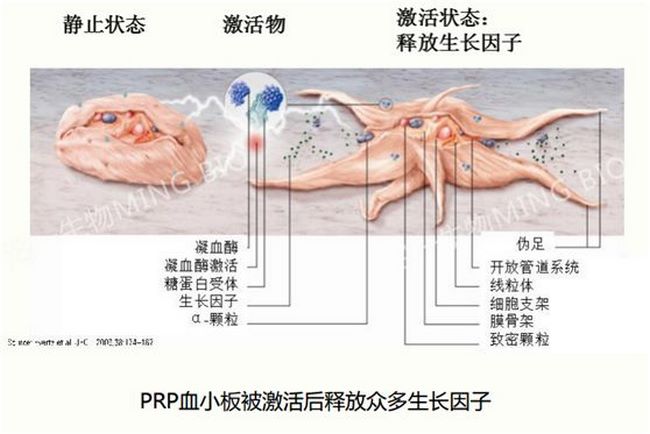 蕪湖市中醫(yī)醫(yī)院首次開展PRP治療難治性外傷(圖5)