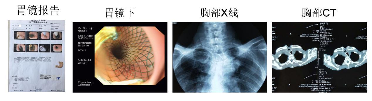 內(nèi)鏡創(chuàng)新工作永遠在路上(圖5)