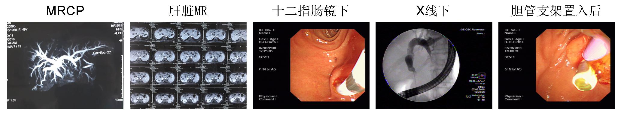 內(nèi)鏡創(chuàng)新工作永遠在路上(圖9)