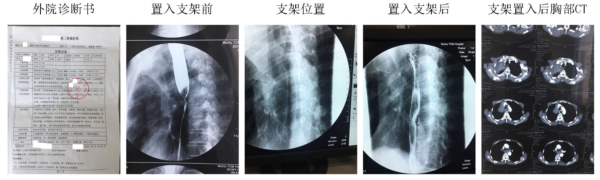 內(nèi)鏡創(chuàng)新工作永遠在路上(圖2)