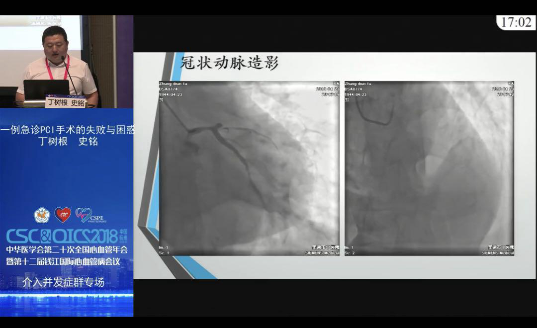 我院心內(nèi)科受邀在2018全國(guó)心血管年會(huì)做精彩病例報(bào)告(圖4)