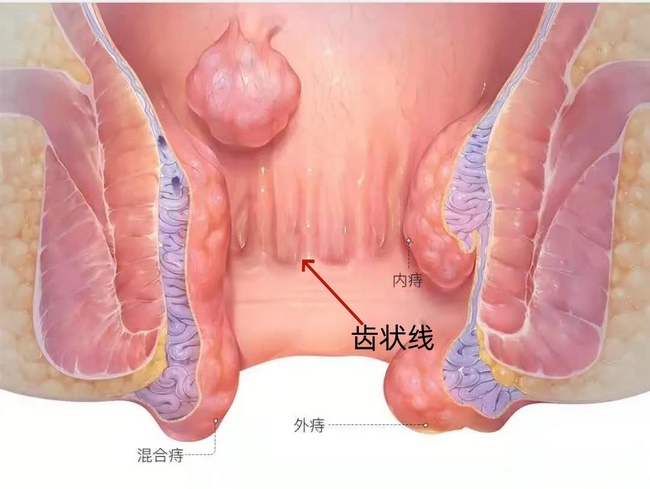 圖片1_副本 肛腸 (Copy).jpg