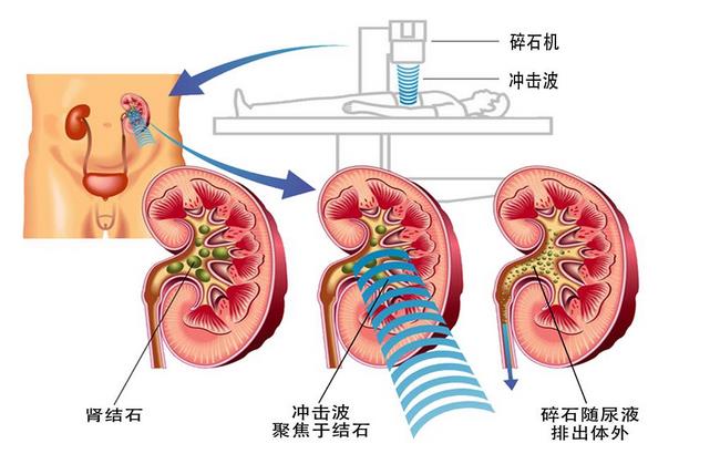 圖片5 (復(fù)制).jpg