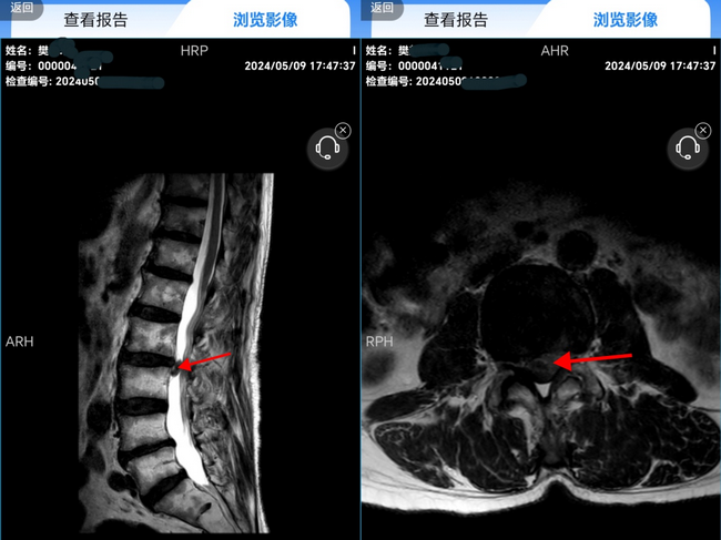 針灸2 (Copy).png